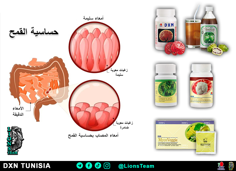 حساسية القمح